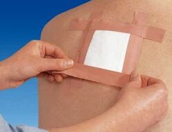 Uporaba terapevtskega obliža za bolečine v hrbtu