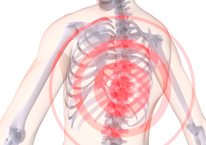 Osteohondroza torakalne hrbtenice
