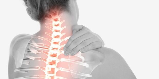 bolečine v vratu zaradi osteohondroze