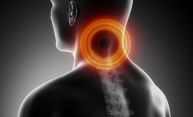cervikalgija s cervikalno osteohondrozo